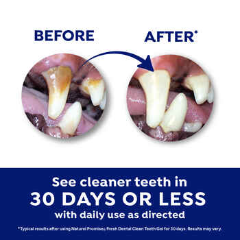 Naturel Promise Fresh Dental Clean Teeth Gel 4 oz