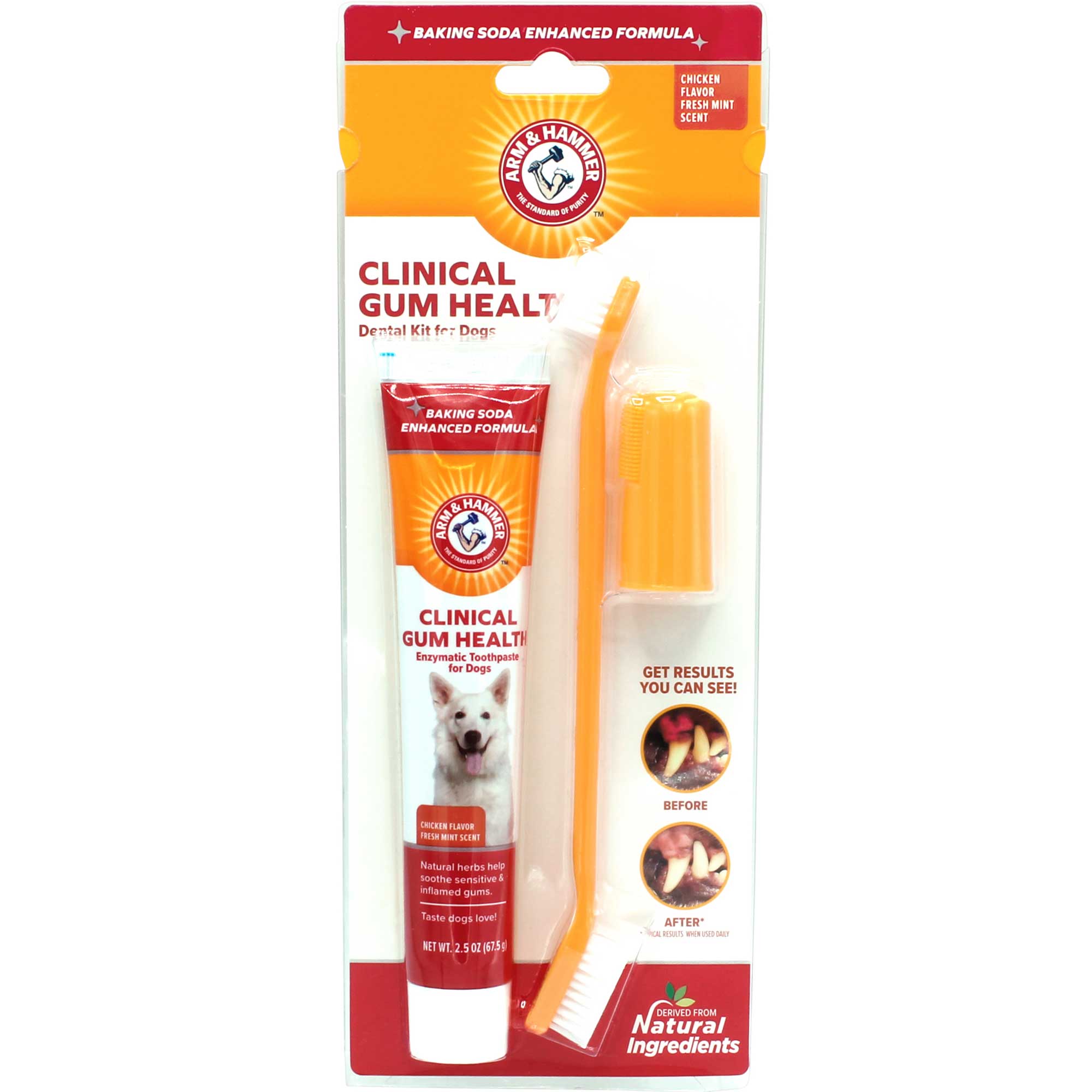 Arm & Hammer Clinical Gum Health Dental Kit Usage
